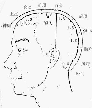 囪會穴|醫砭 » 經穴庫 » 囟會